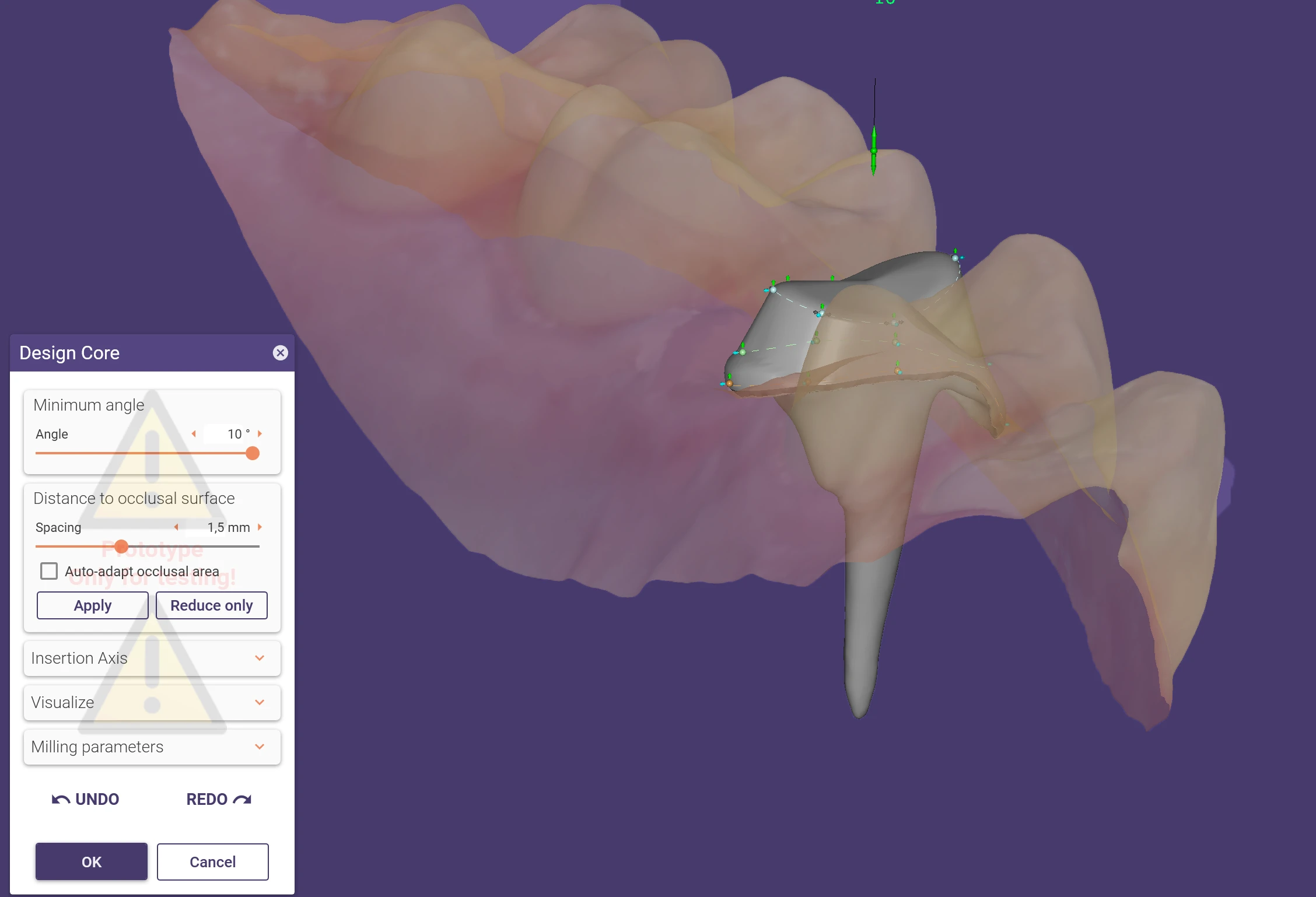 exocaddentalcadelefsinapage3post-and-core